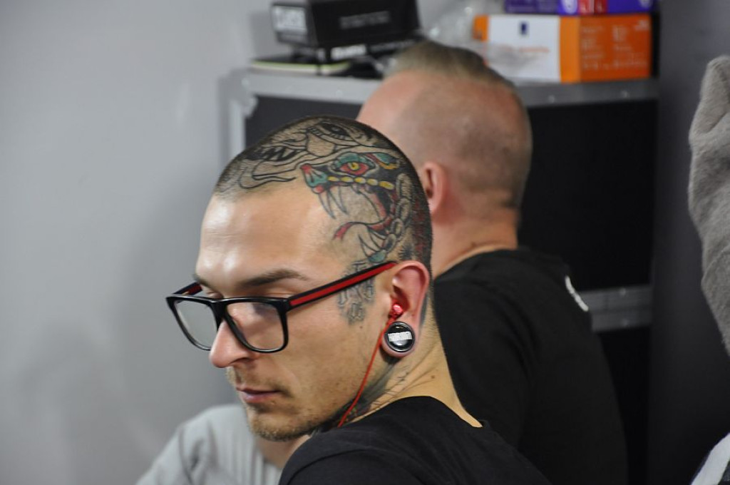 Igły rozgrzane do czerwoności